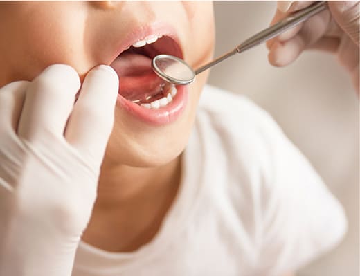 小児歯科治療・予防矯正治療
