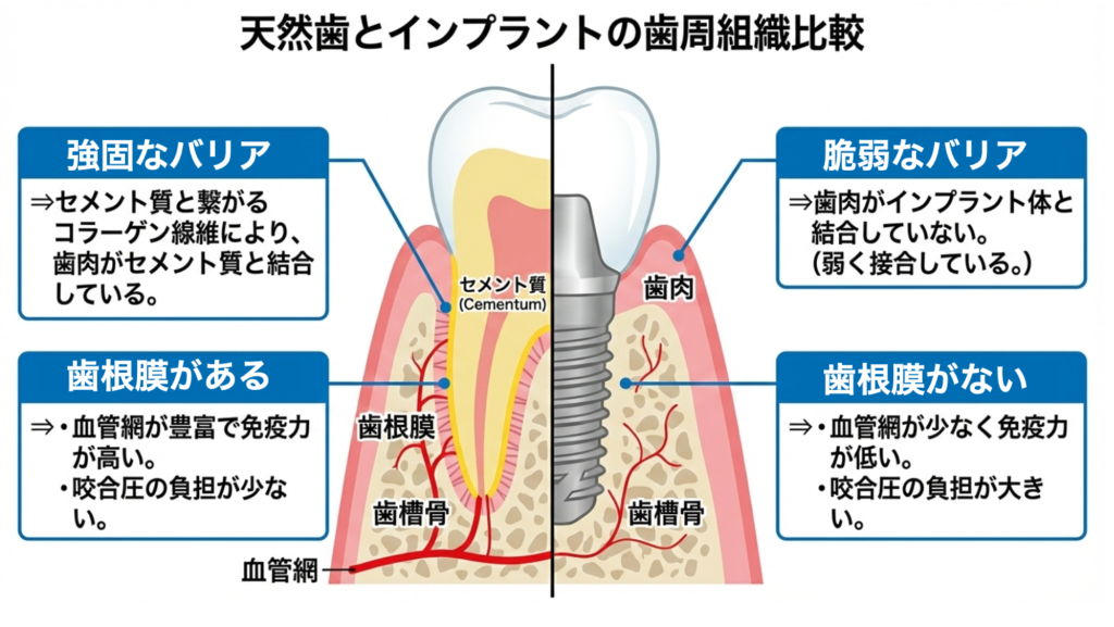 天然歯とインプラントの歯根膜・血流比較図