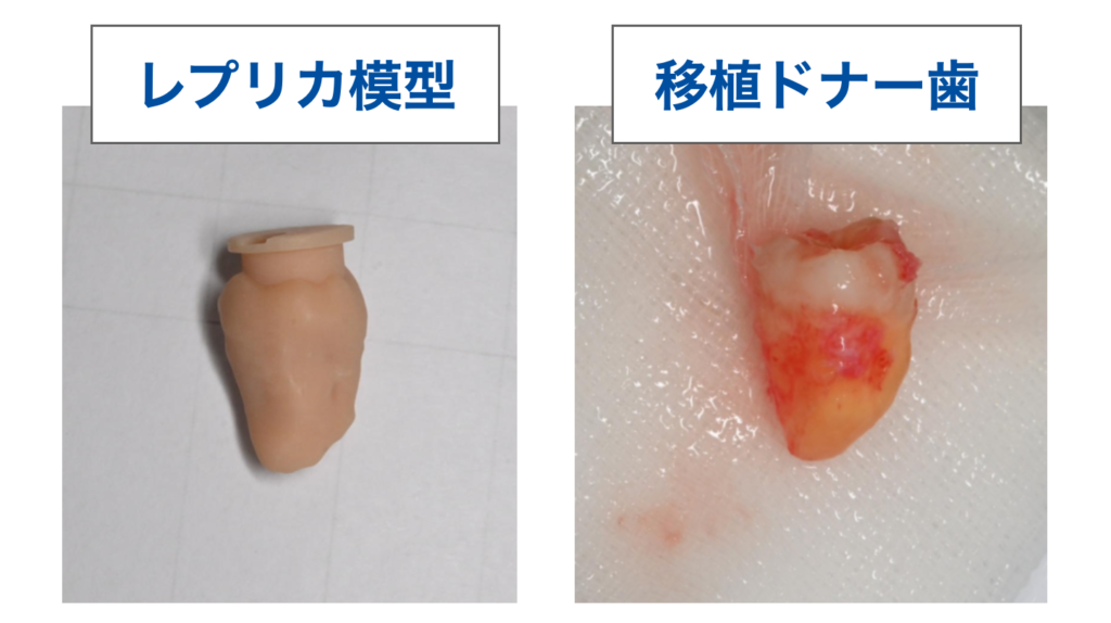 歯牙移植　レプリカ模型　移植ドナー歯